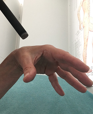 Médecine traditionnelle chinoise - Moxibustion